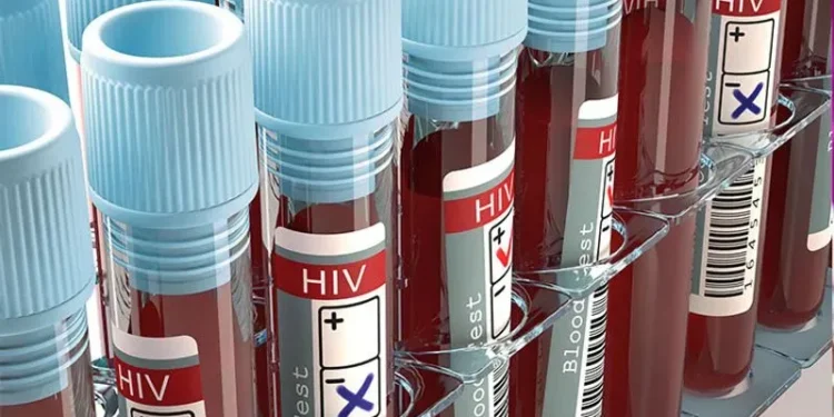 HIV Cases in Mityana Double, Health Officials Sound Alarm!